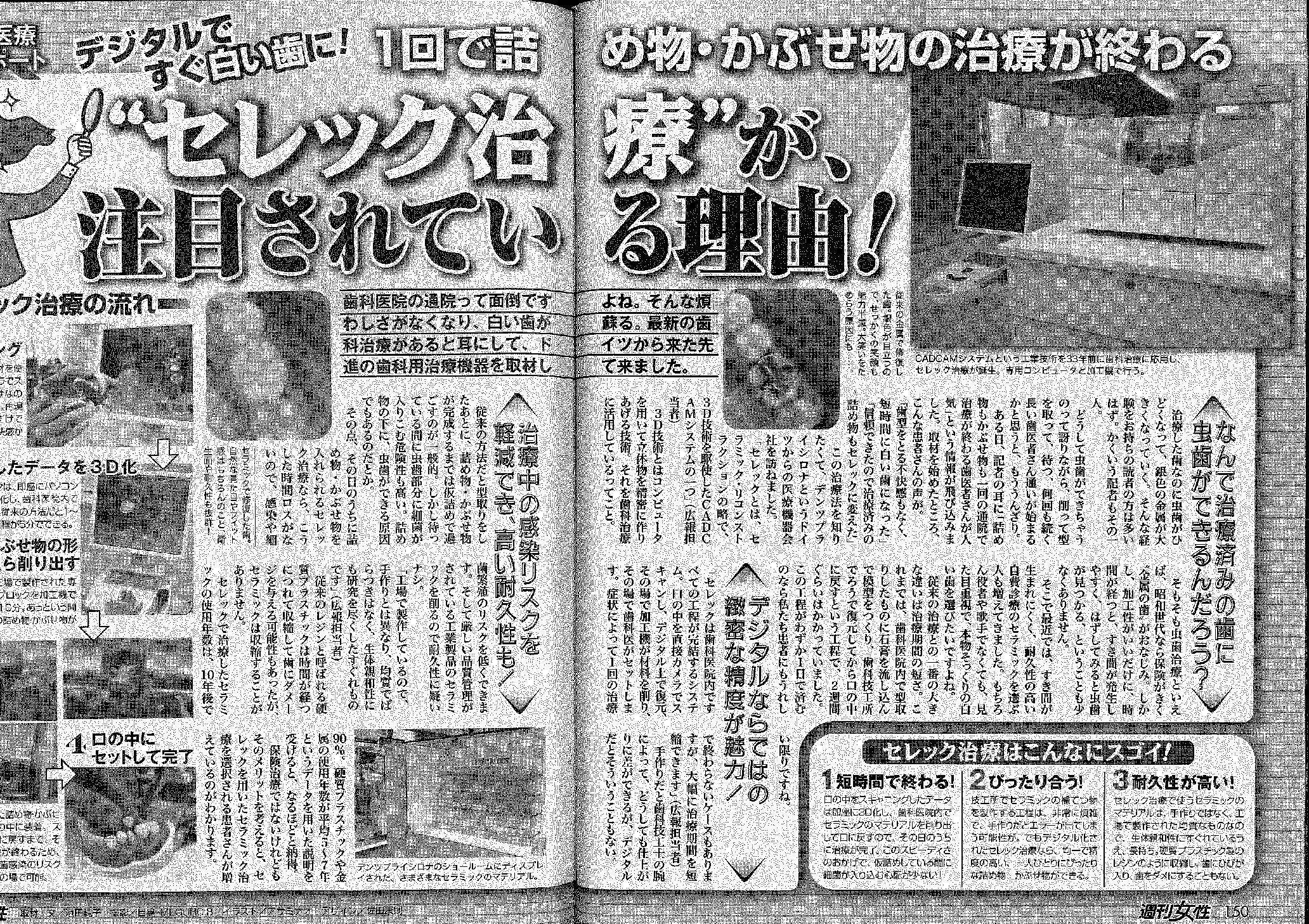 セレック